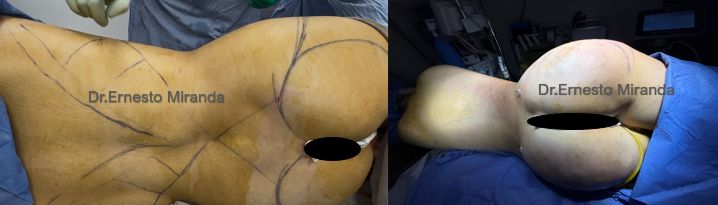 Ernesto Miranda Cervantes-4