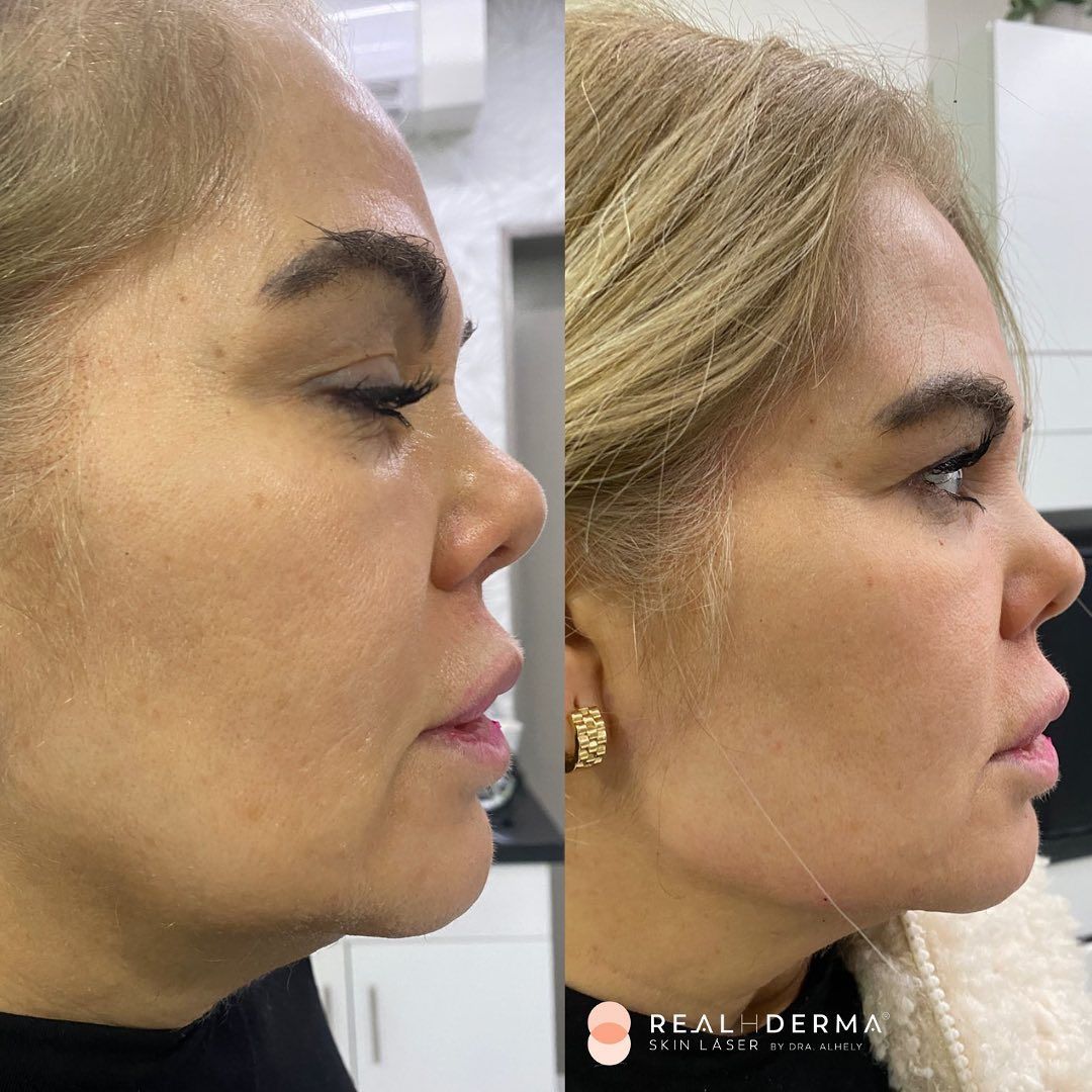 Laura Alheli Niebla Maldonado-9