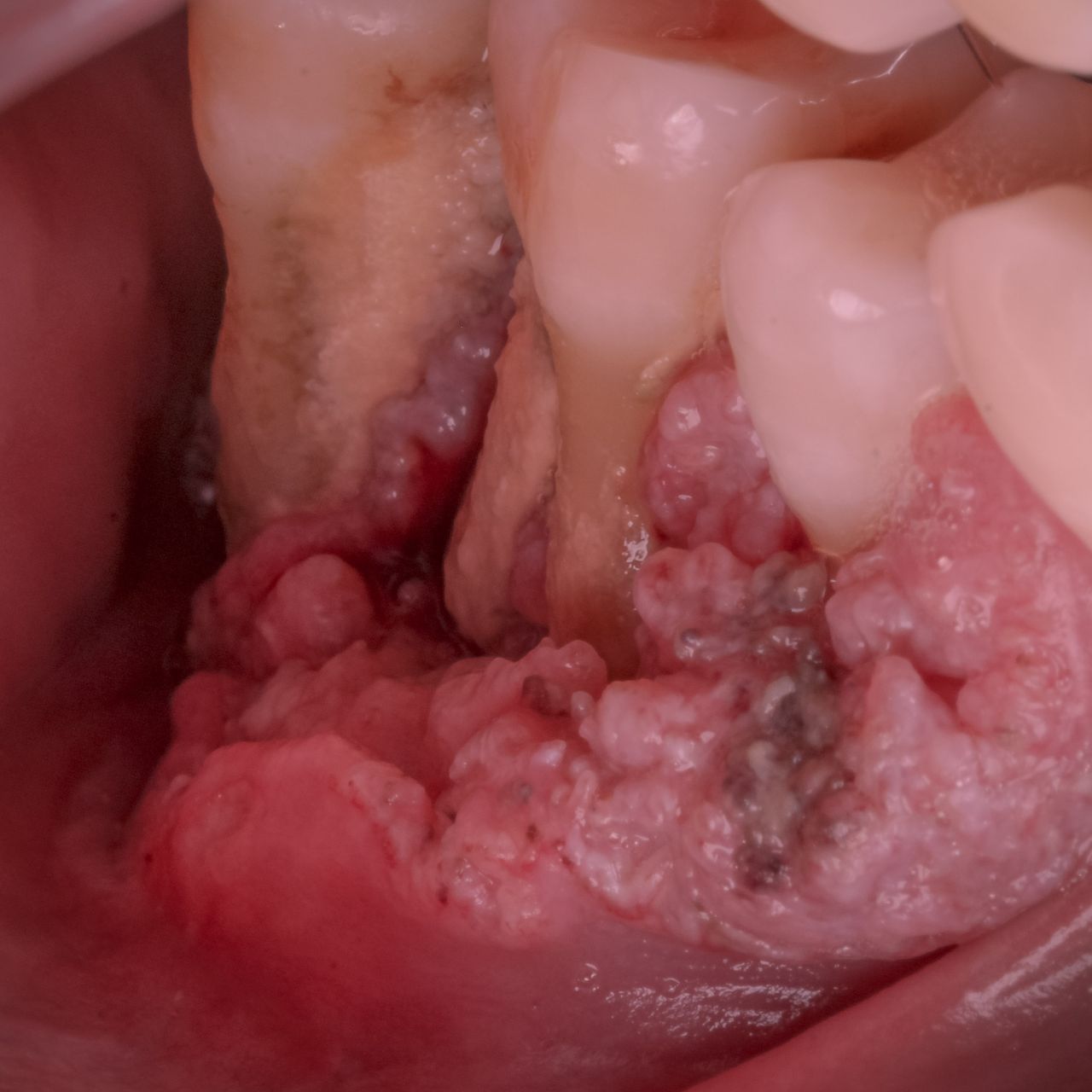 Hugo Enrique Aguilar Lamas-102