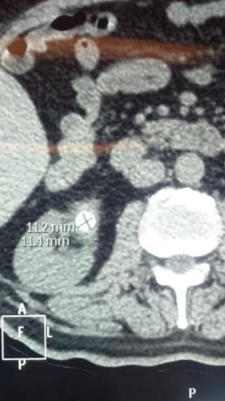 Pedro Enrique Martínez Constantino-19