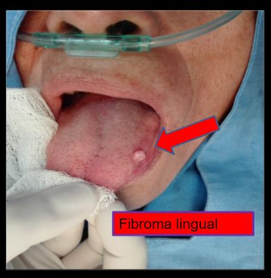 Diana Araceli Dávila Hernández-20