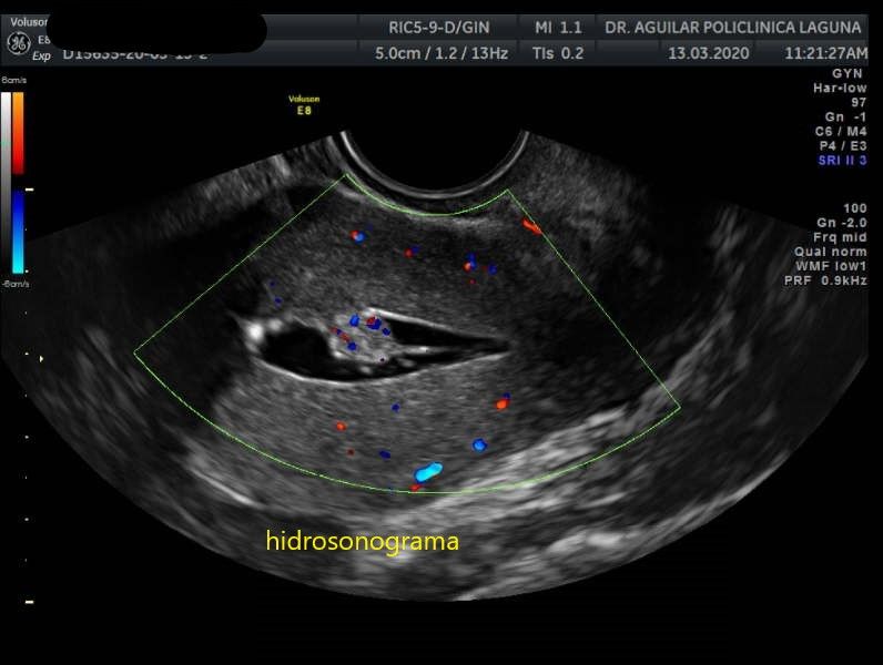 Edgar Fernando Aguilar Morales-0