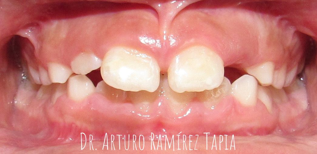 Arturo Ramírez Tapia-18