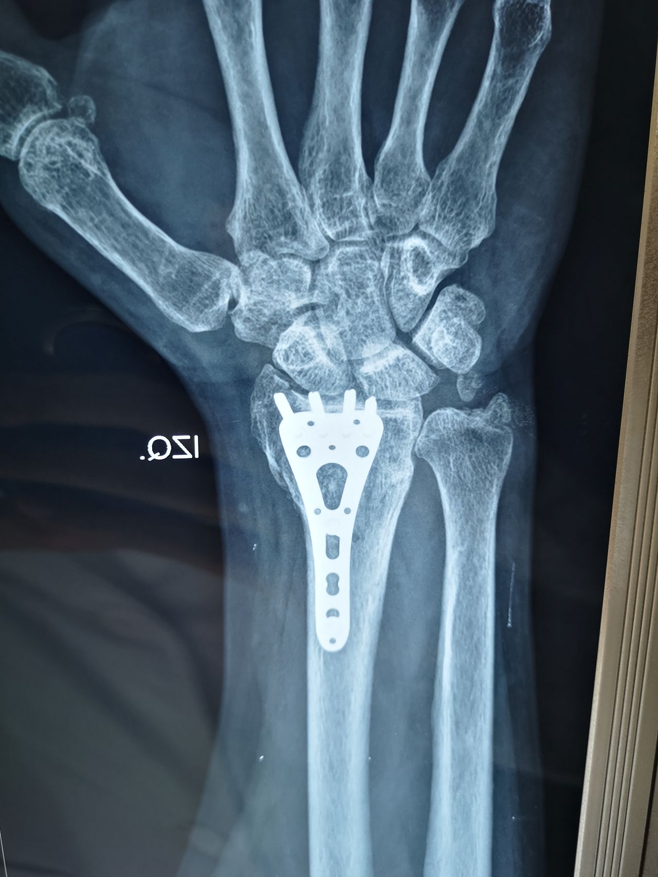 Manuel Ernesto Palma Palma-7