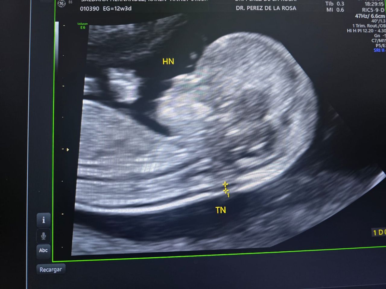 Abraham Ignacio Pérez De La Rosa-23