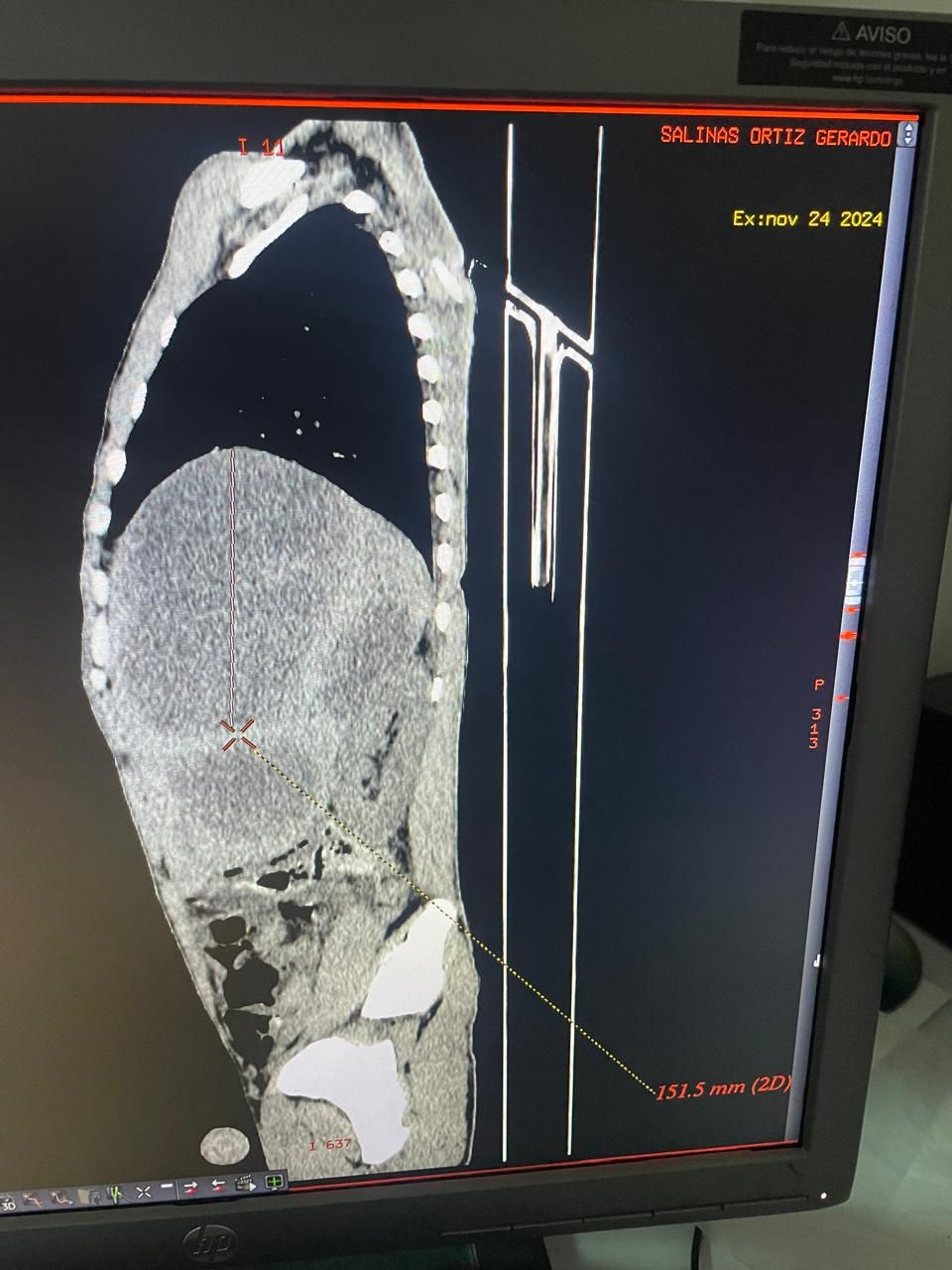 Jose Abraham Sauceda Ramirez-12
