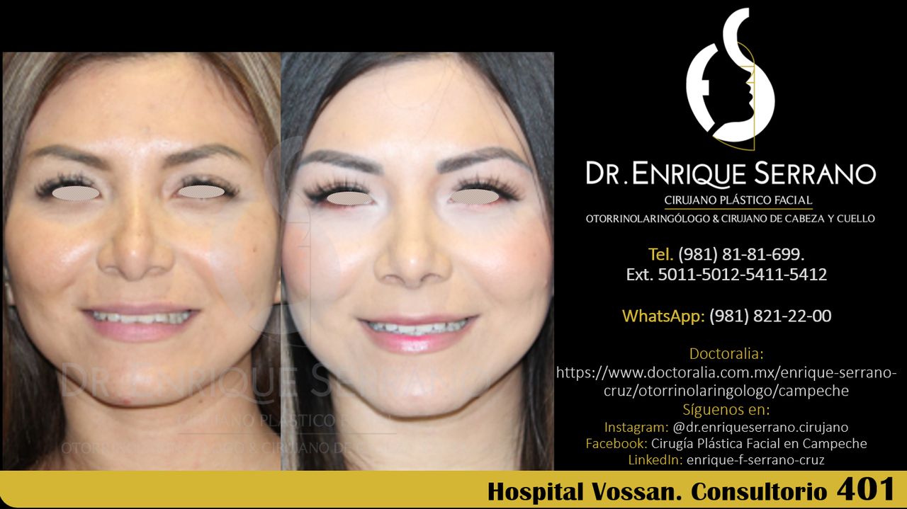 Enrique Serrano Cruz-85