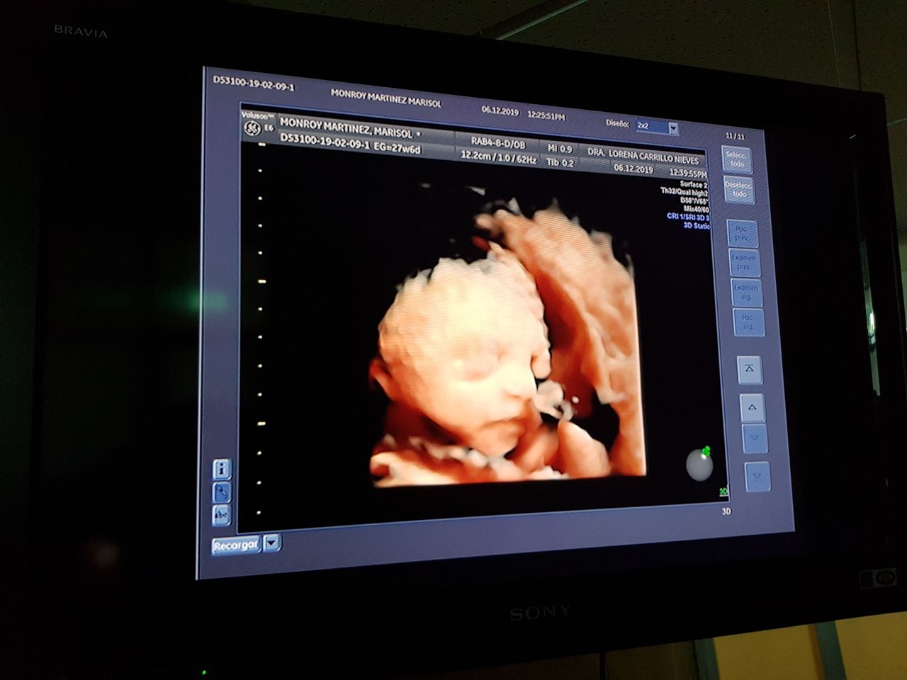 Lorena Carrillo Nieves-2