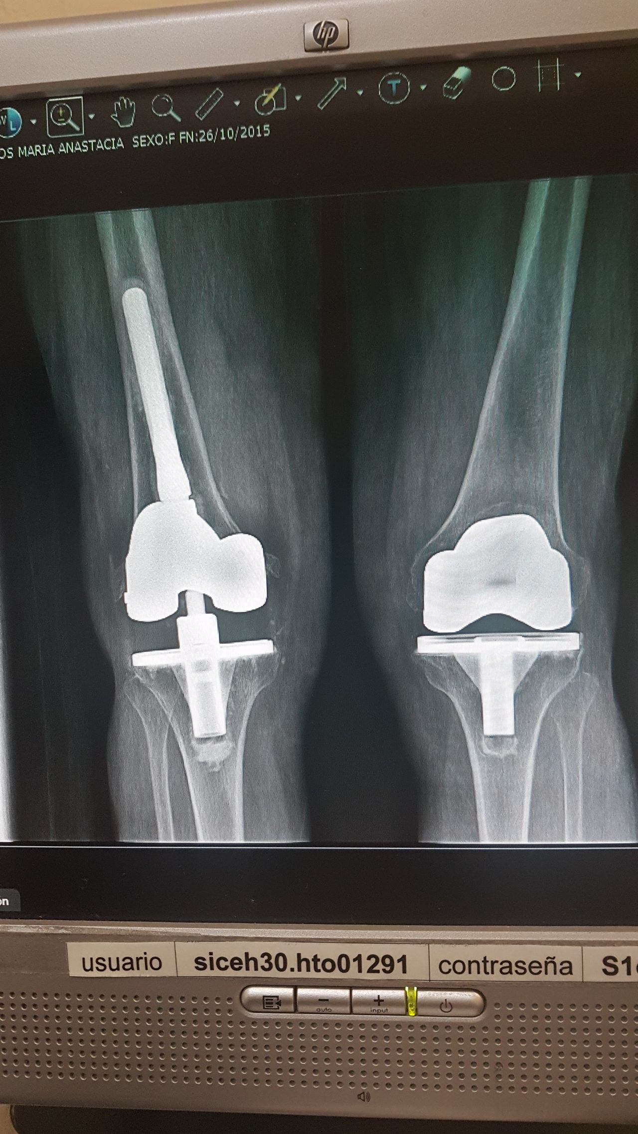 Ramon Garcia Acosta-8