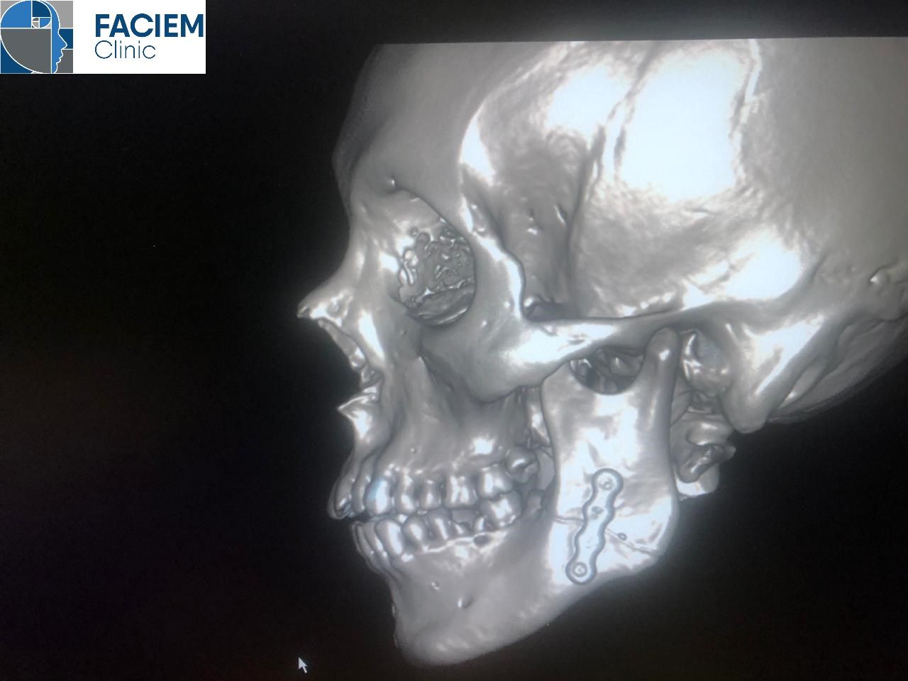 Arlen Colín Ordaz-24