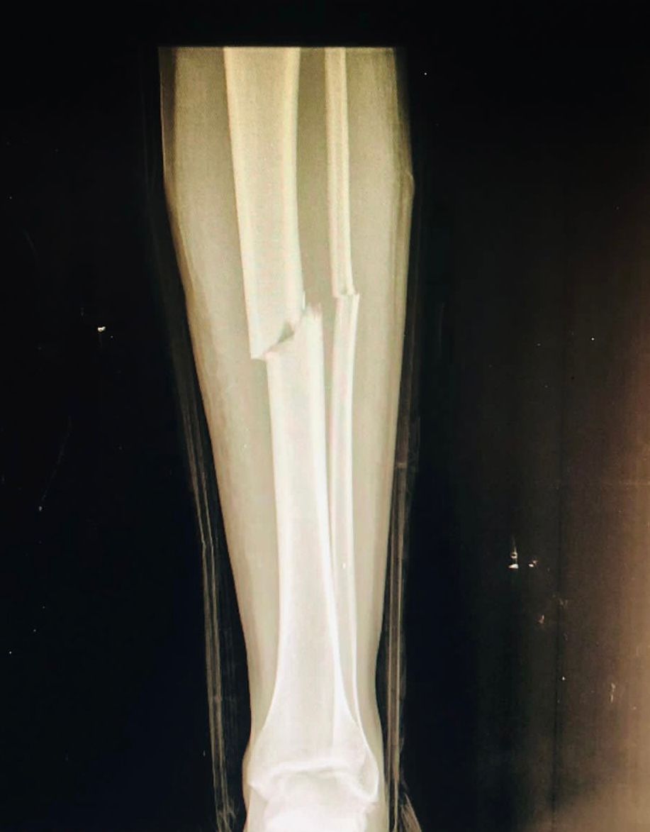 Josmar Adrián Lopez Eng-7