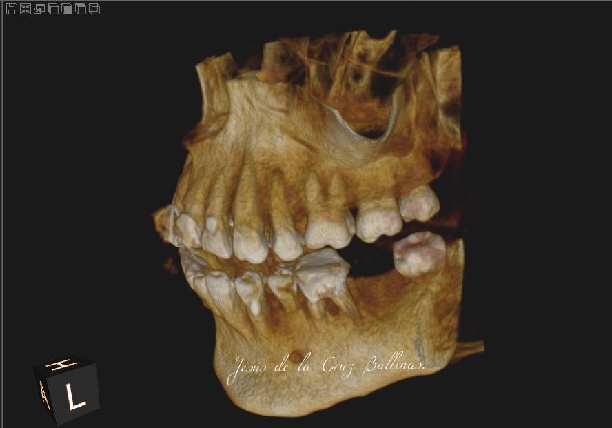 Jesus De La Cruz Ballinas-15