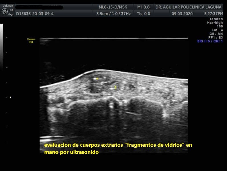 Edgar Fernando Aguilar Morales-10