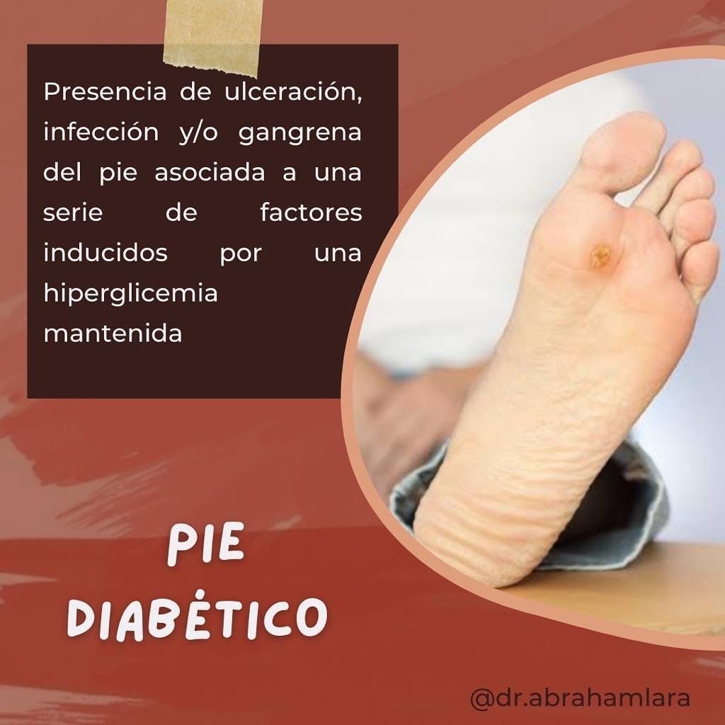 Miguel Abraham Lara Perez-26