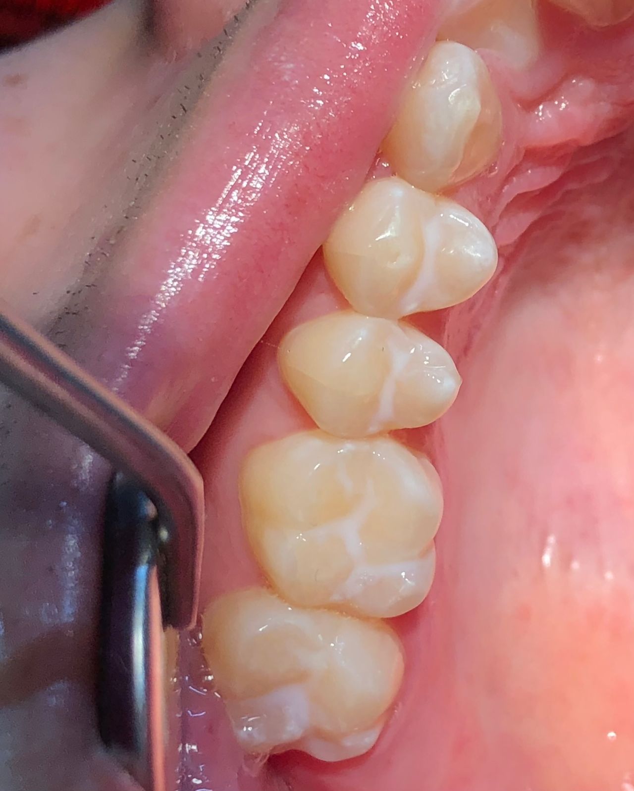 María Paula  Flores Novoa-45