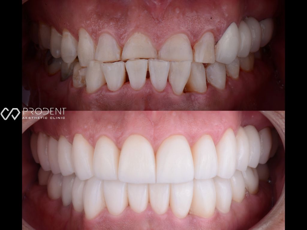 Ulises Pérez Murillo-64