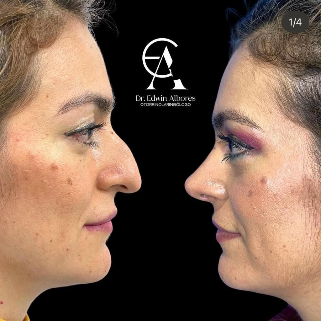 Edwin Hernandez Albores-0