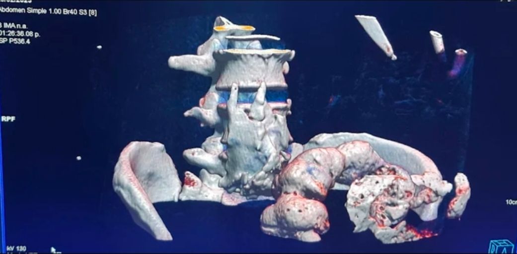 Blanca Teresa González Rocha-6