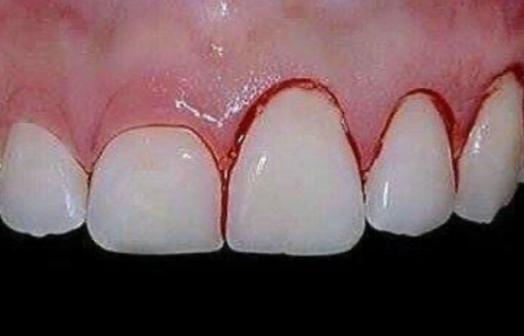 Carlos Candelaria Margarito-7