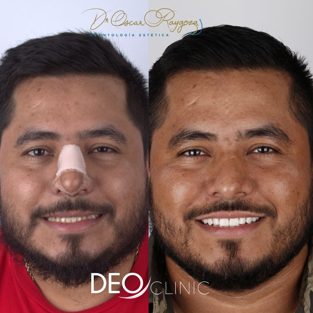 Oscar Raygoza Carrillo-26