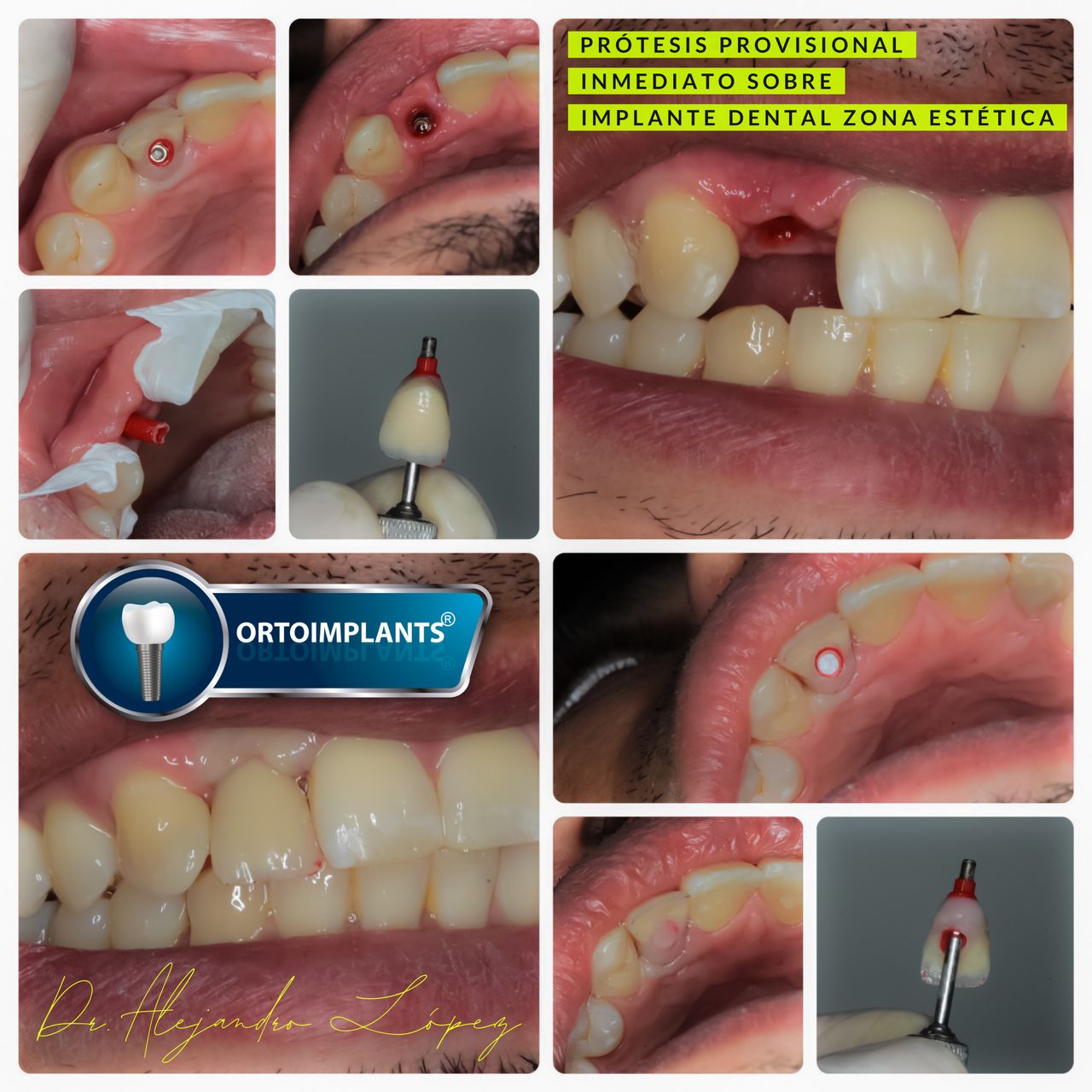 Javier Alejandro López García-33