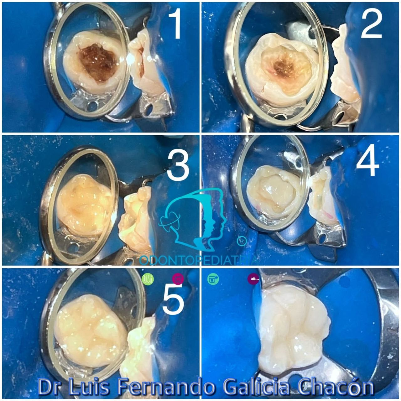 Luis Fernando Galicia Chacón-34