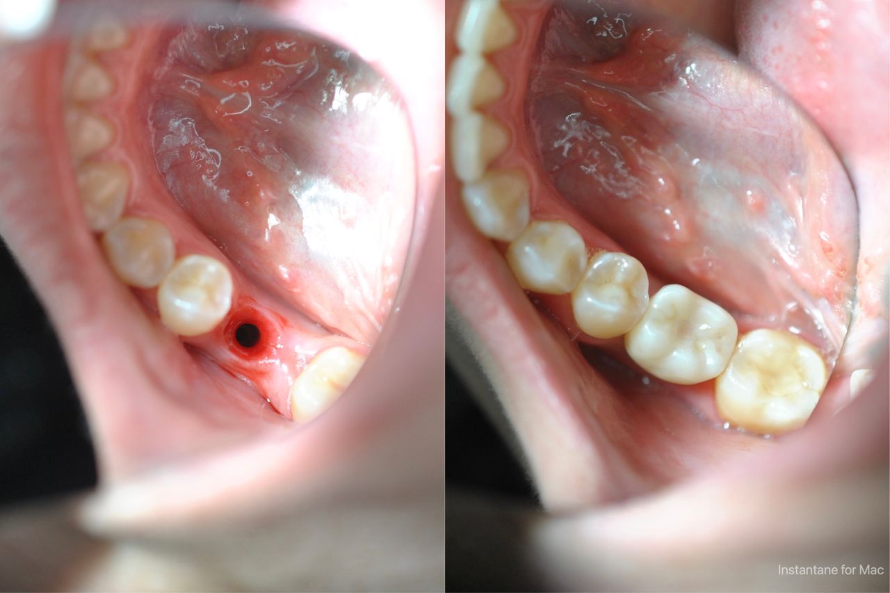 Joel Alejandro Sánchez Zúñiga-1