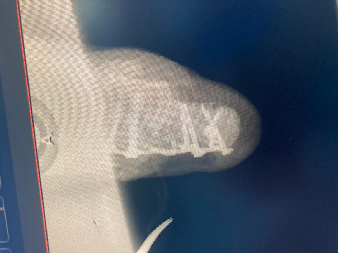 Noe González Plata-8