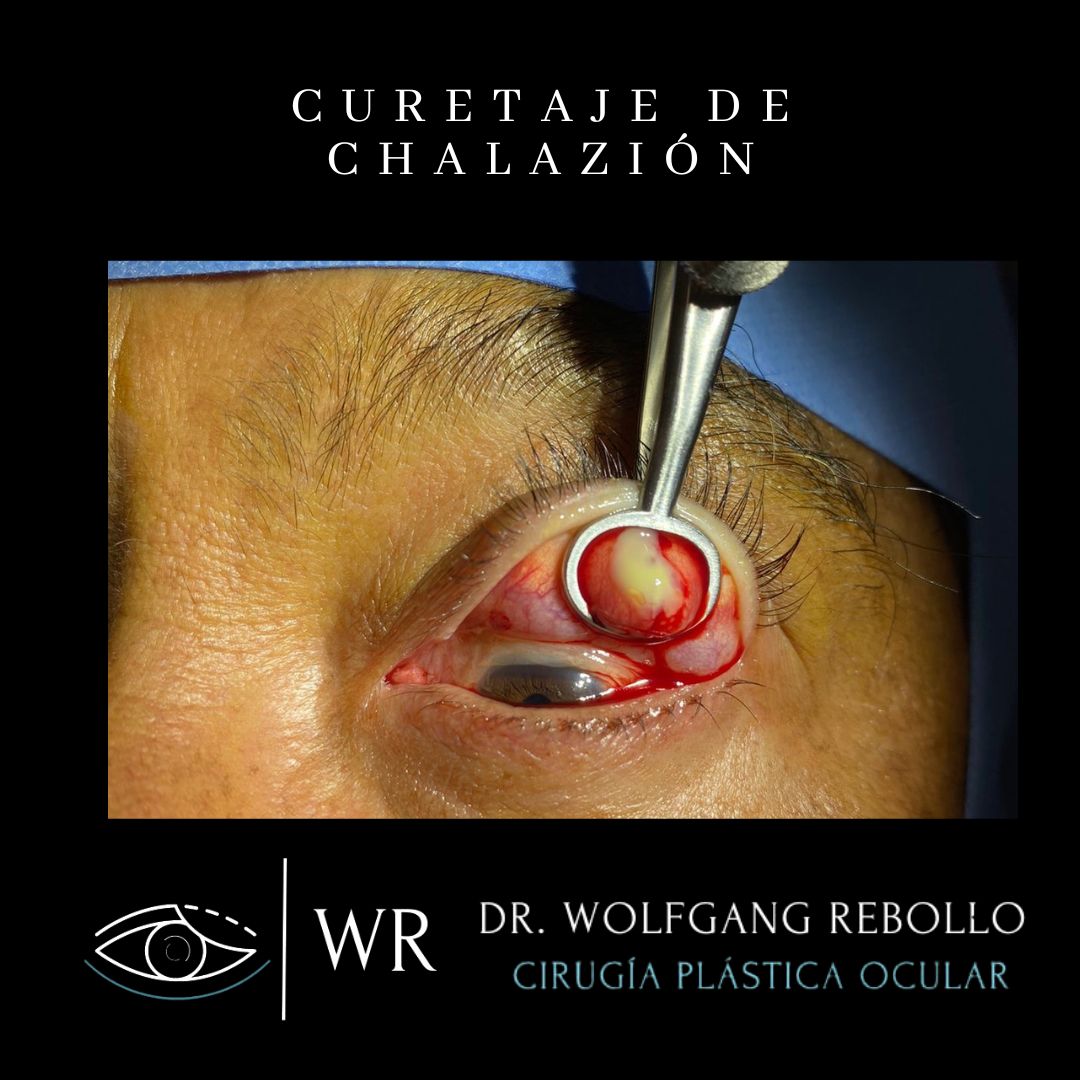 Wolfgang Rebollo Ramírez-10