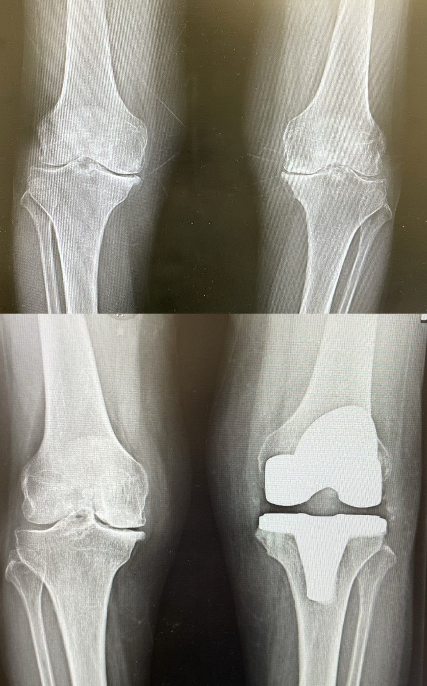 Diego Armando Contreras Rojas-9