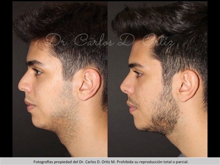 Carlos David Ortiz Moreno-13