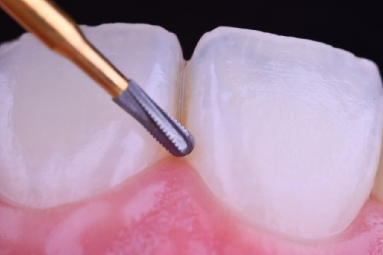 Angélica Saavedra Camacho-6