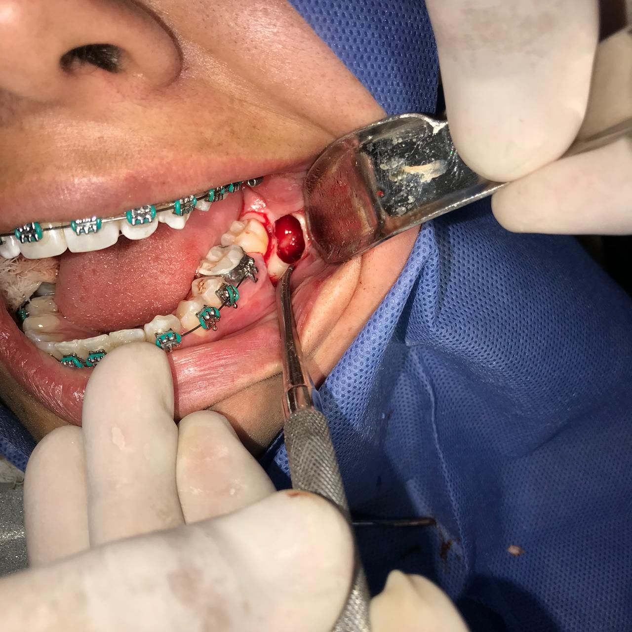 Miguel Tapia Ruiz-12