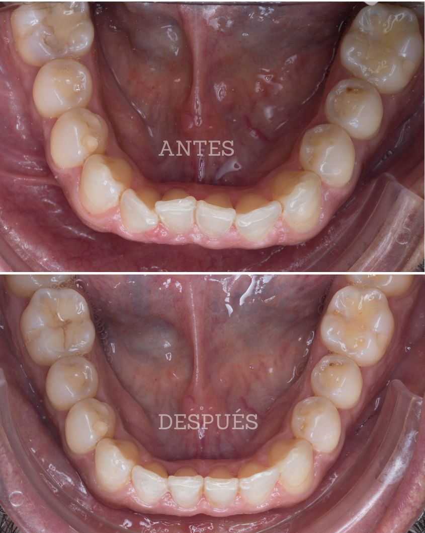 Yalile Talamas Troyo-8