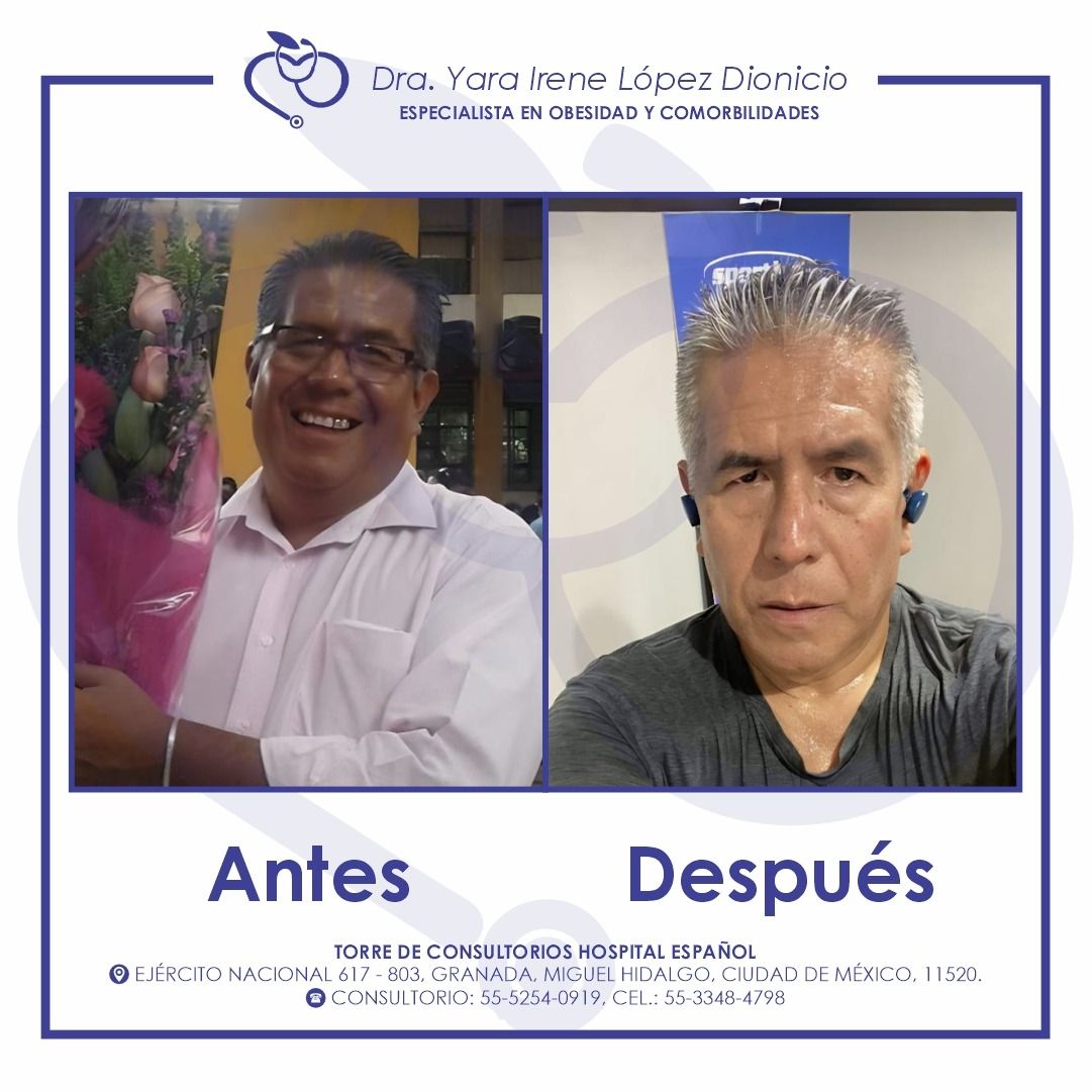 Yara Irene López Dionicio-4