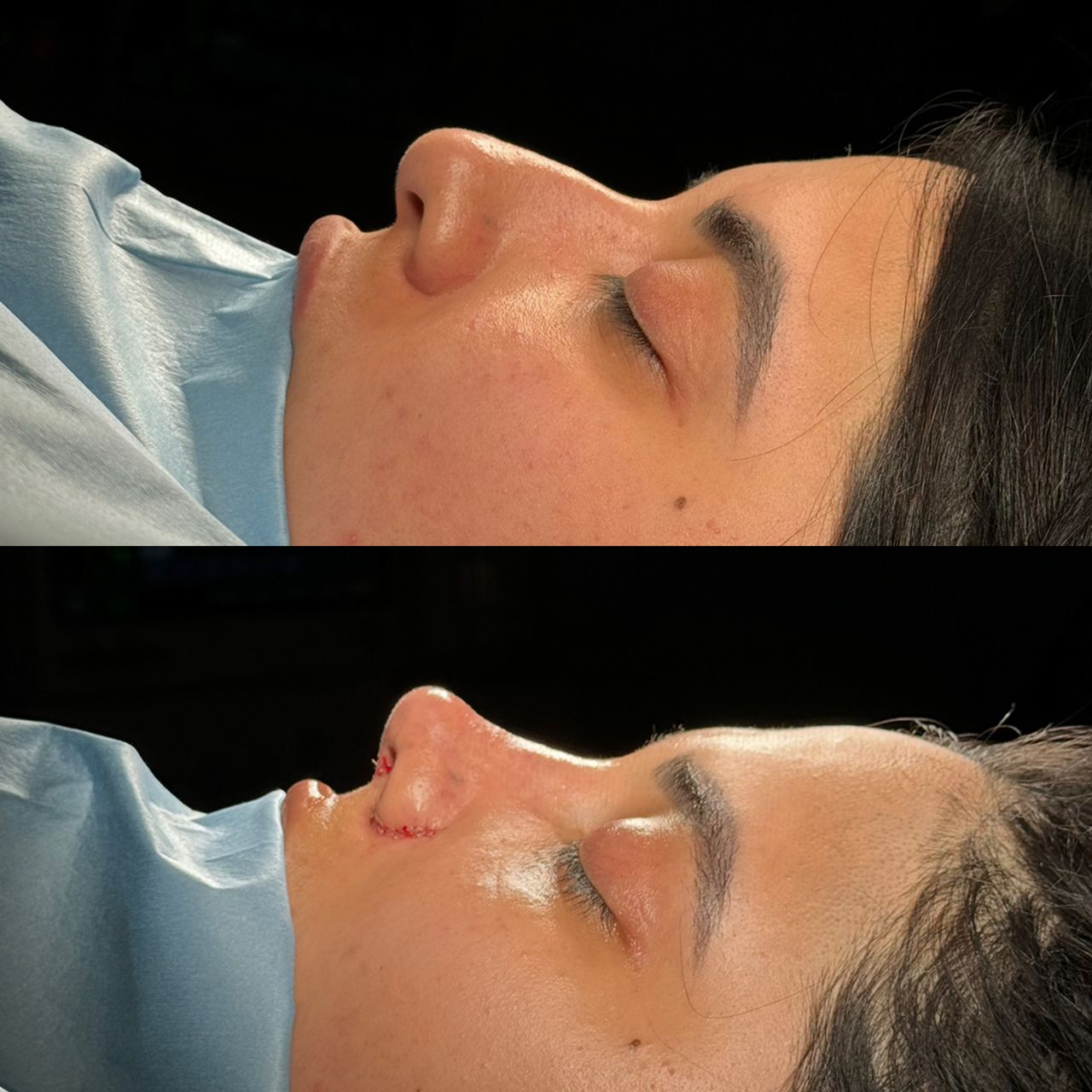 Angel Castro Urquizo-83