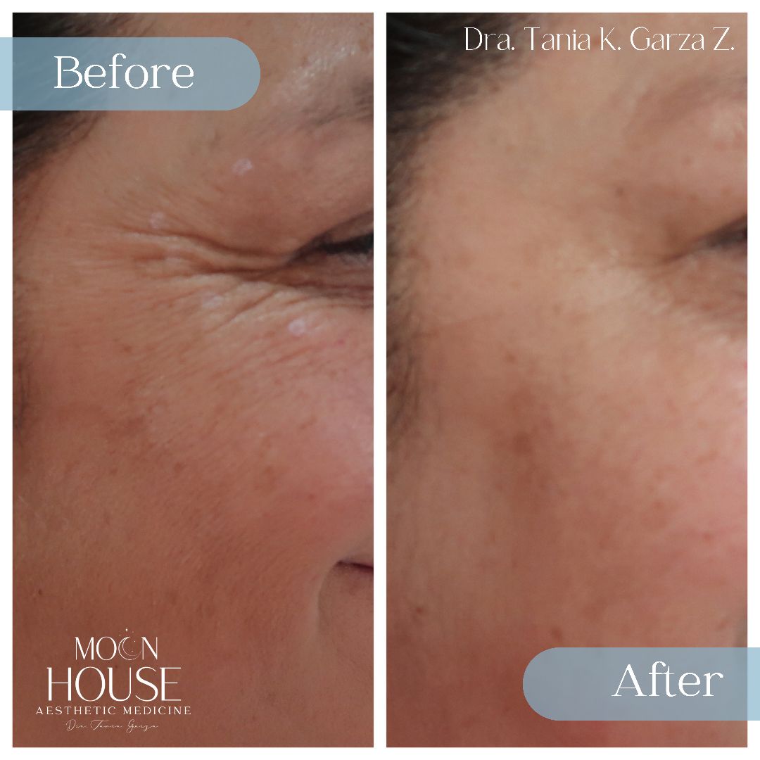 Tania Karine Garza Zepeda-5