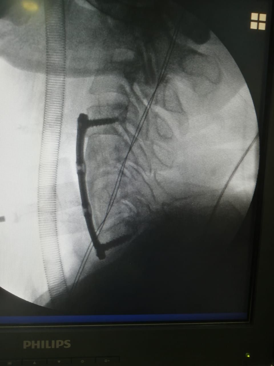 Juan José Luévano De La Cruz-34