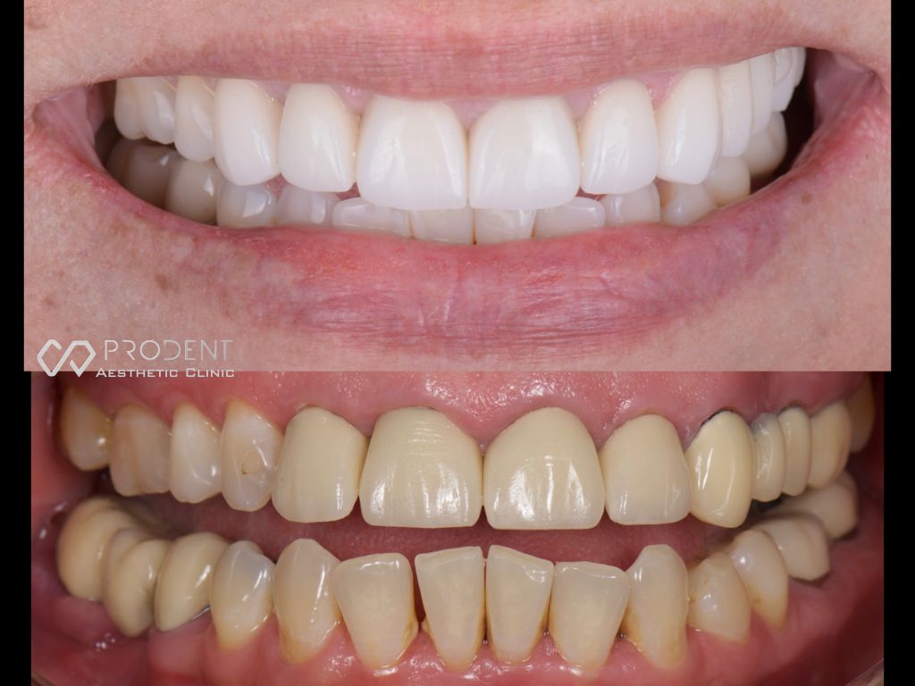 Ramiro Ivan Pérez Murillo-63