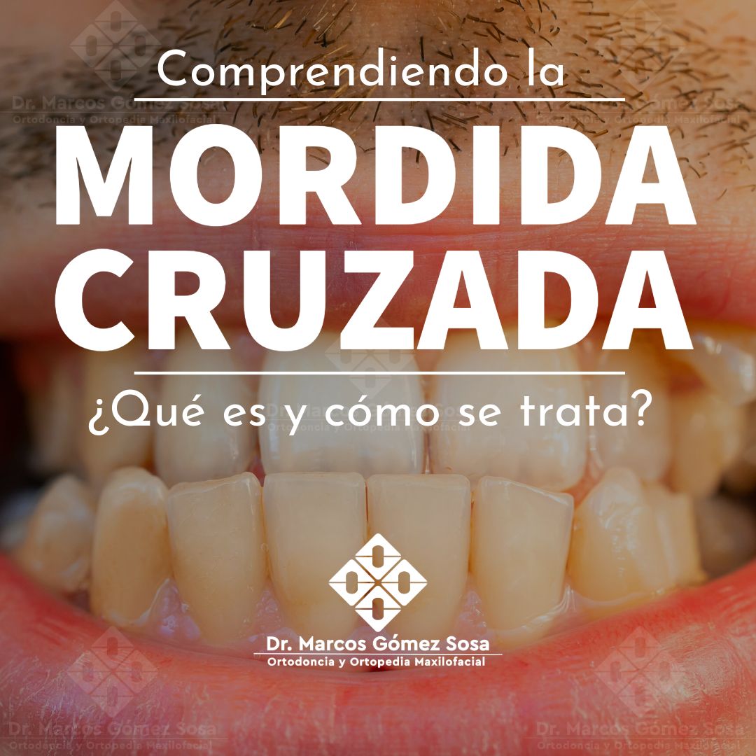 Marcos Gómez Sosa-64