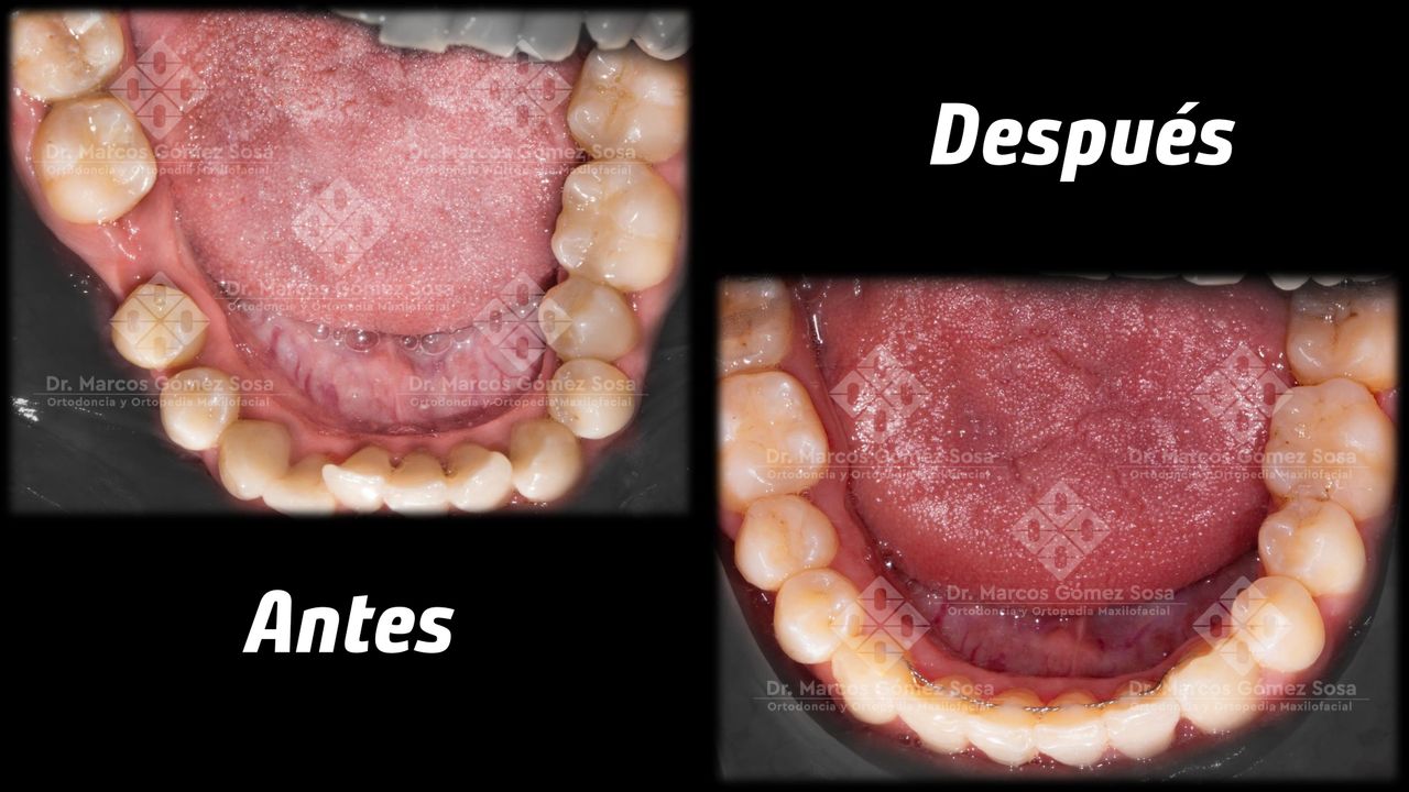 Marcos Gómez Sosa-13