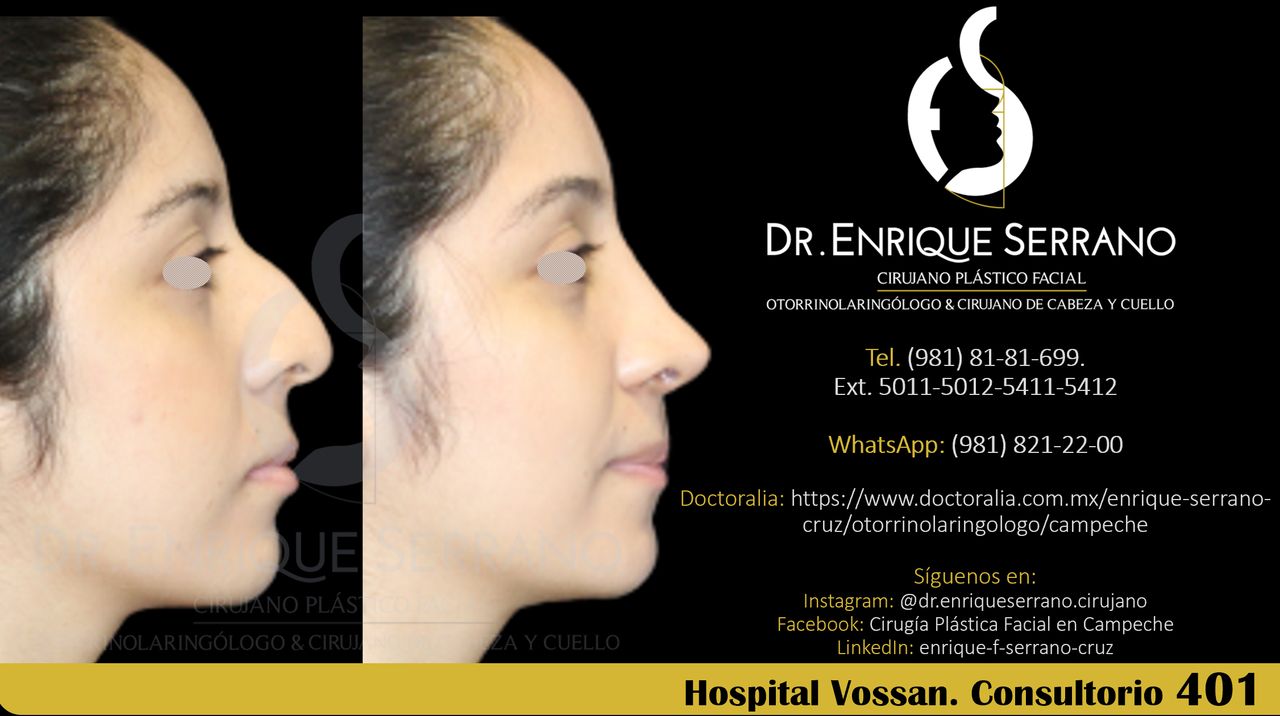 Enrique Serrano Cruz-114