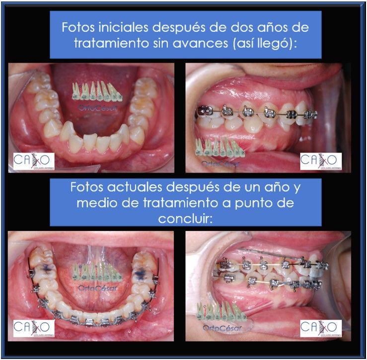 César Augusto Pérez Córdova-30