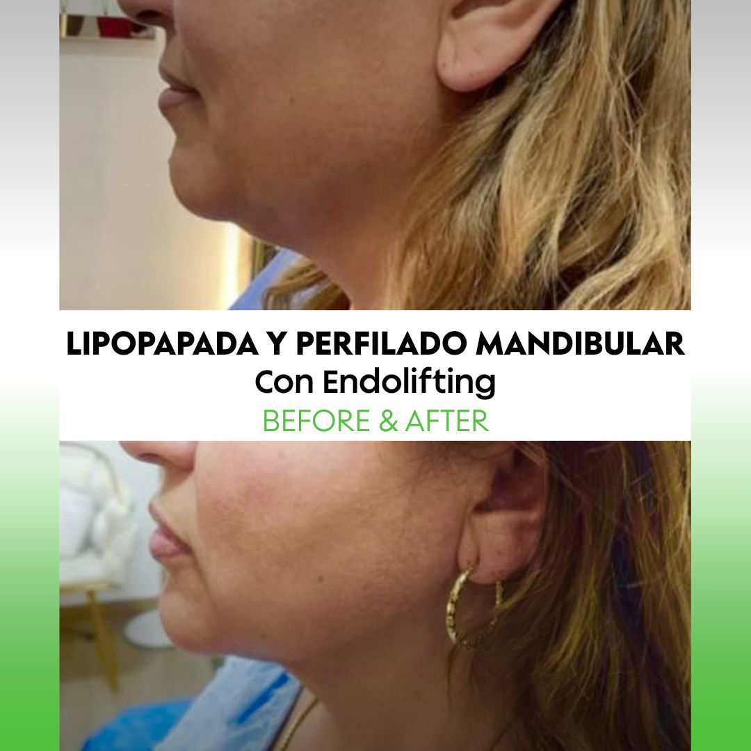 Alejandra Soriano Elorza-113