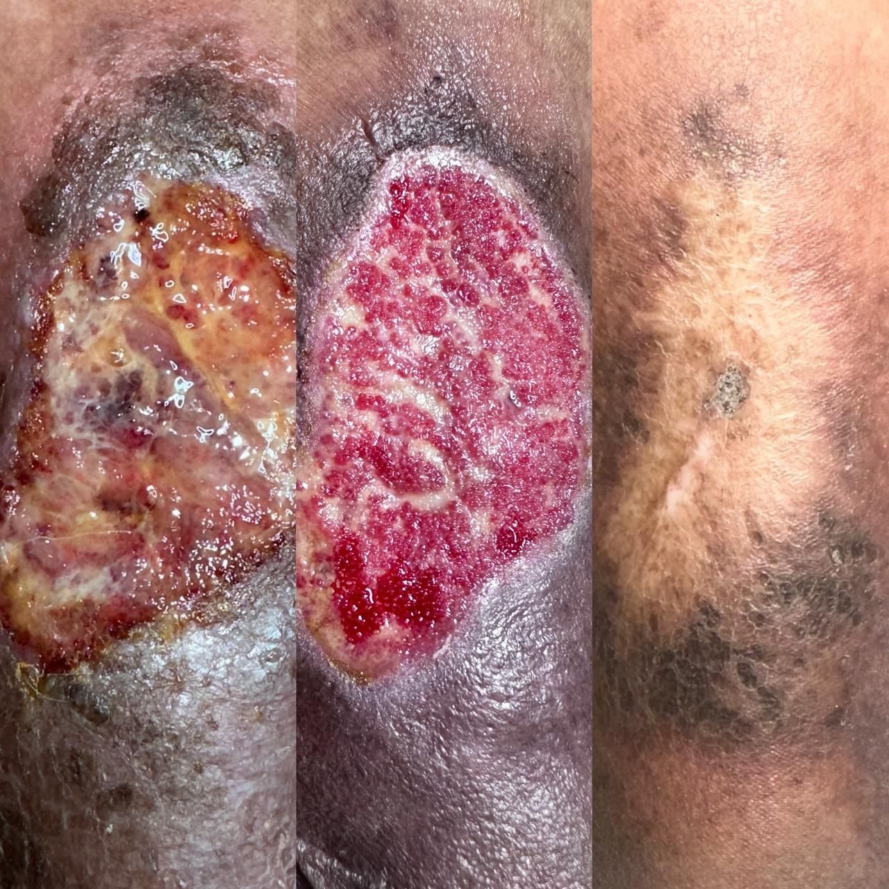 Jhonatan López González-41