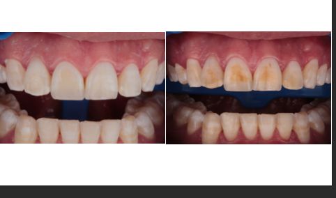 Andrea Cervantes Urenda-14