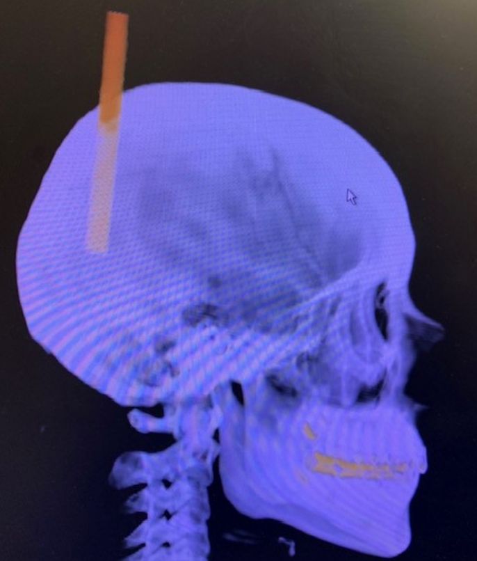 Griselda Collado Arce-12