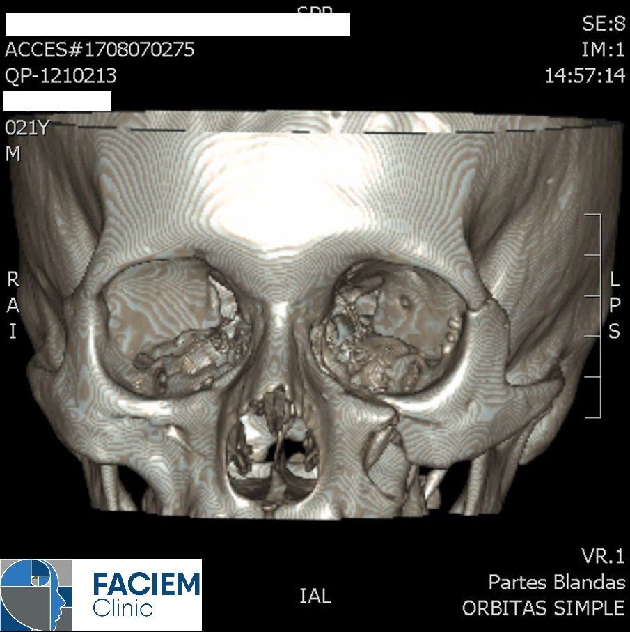Arlen Colín Ordaz-45