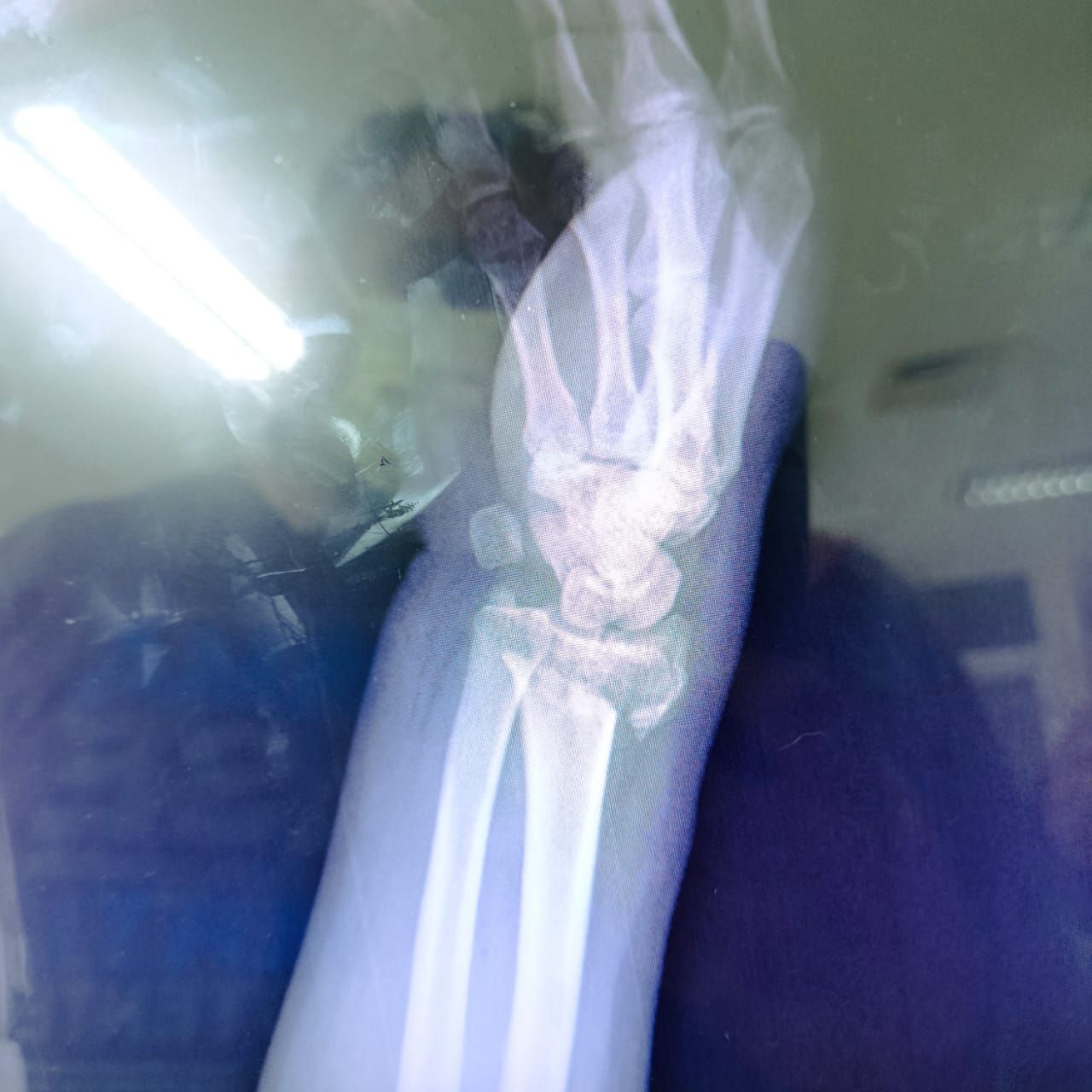 Alejandro Irisson-14