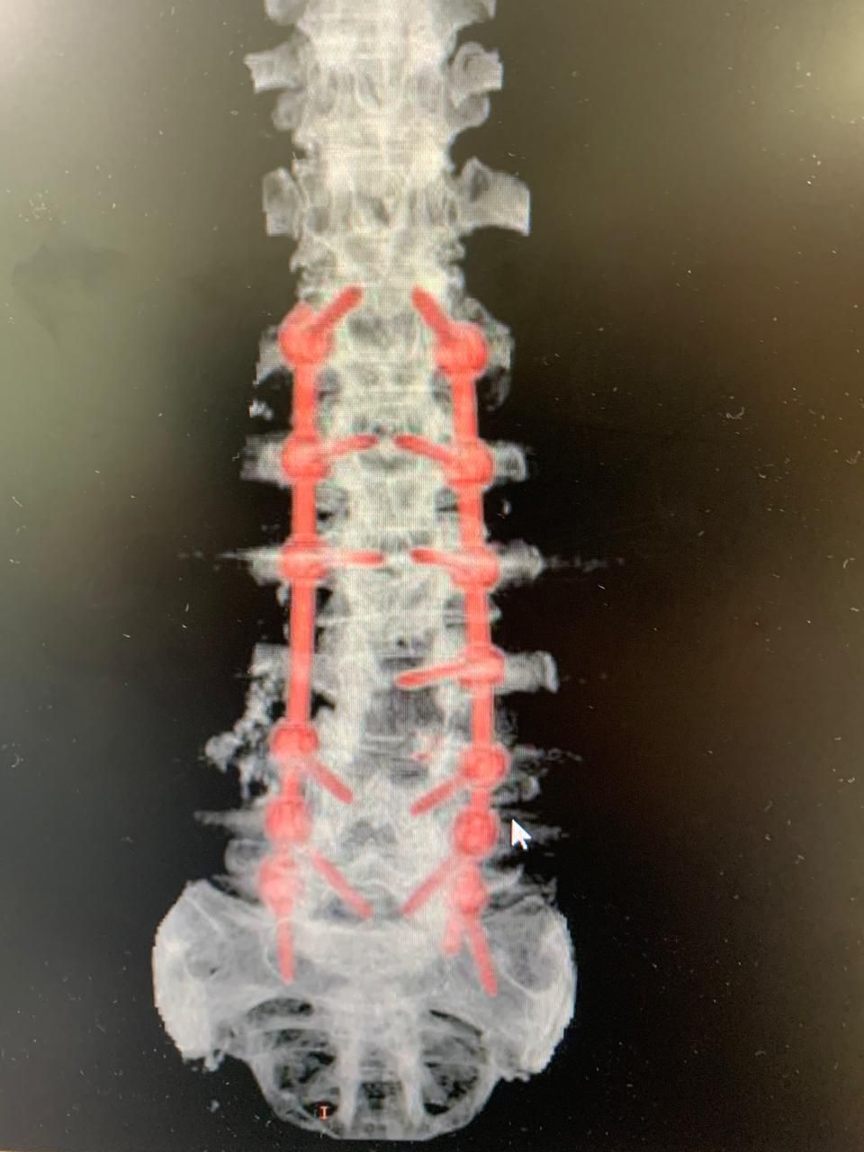 Ricardo Reyna Reynoso-6